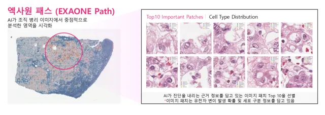 엑사원 패스는 전체 슬라이드 이미지(WSI)에서 암과 관련된 유전자 변이를 예측할 수 있다. LG 제공