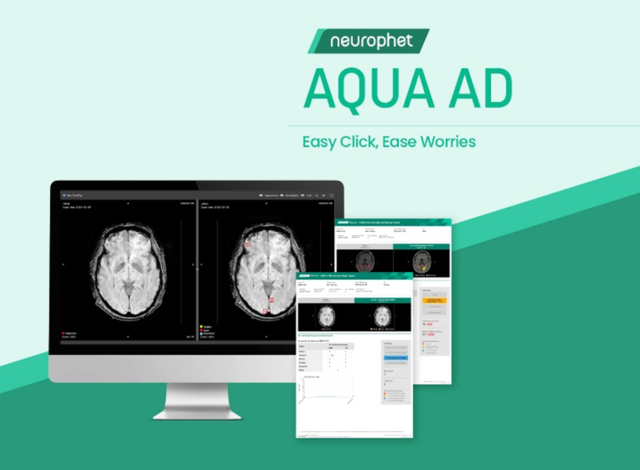 뉴로핏의 뇌 영상 검출 및 진단 보조 소프트웨어 ‘뉴로핏 아쿠아 AD 플러스’ 사용 모습. 뉴로핏 제공.