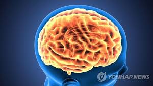 [이미선의 헬스테크] 비만약만 ‘대세’ 아니다…고령화에 중추신경계 치료제 ‘큰 시장’ 열린다