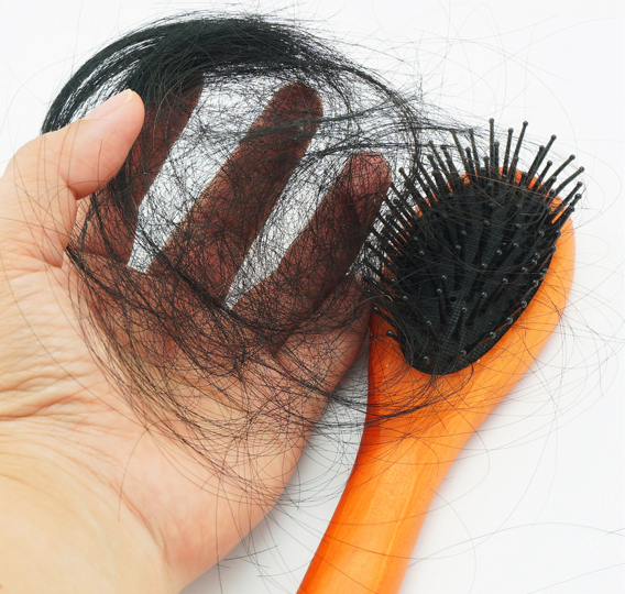 탈모 [아이클릭아트 제공]