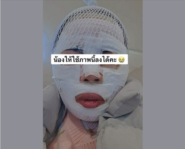 화상 입은 태국인 아내 페이스북 갈무리