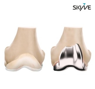 ㈜스카이브, 한국일보 주관 '2025 우수특허대상' 수상, 정형외과 전문... - 뉴스 썸네일 이미지