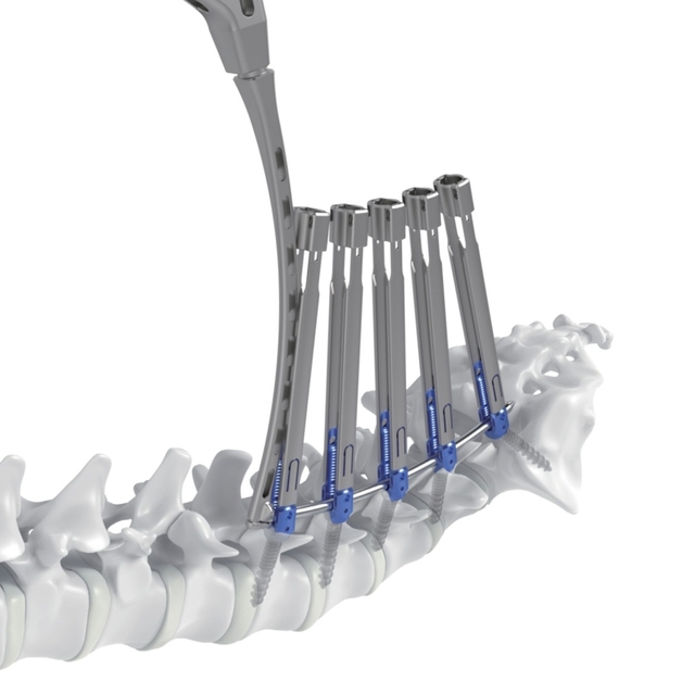 신규 척추 포트폴리오 ‘강휘(Kanghui)’. 메드트로닉코리아 제공