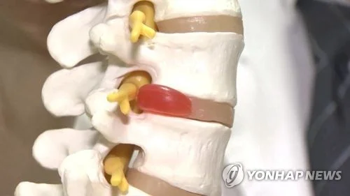 디스크.   * 사진은 기사와 직접 관련이 없습니다.  [연합뉴스TV 제공]