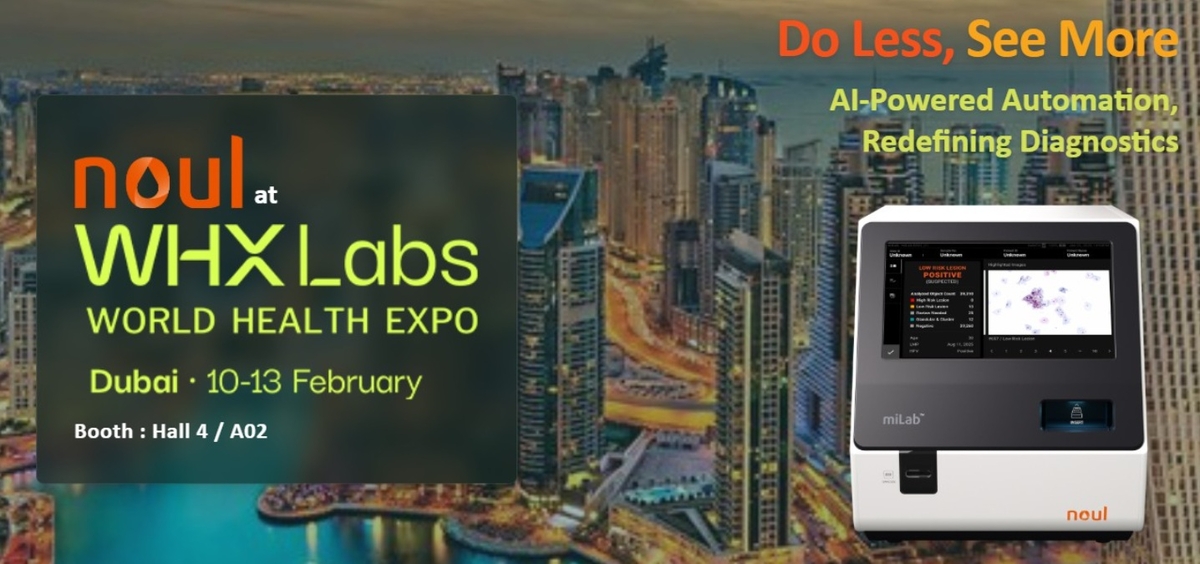 노을, 두바이 전시회서 'AI 자궁경부암 진단 솔루션' 소개...중동 확장... - 뉴스 썸네일 이미지