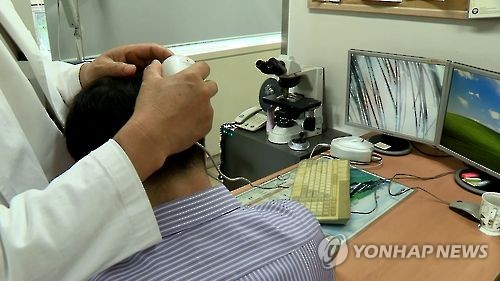 탈모 치료하는 모습. [연합뉴스]