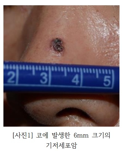 서울아산병원 제공