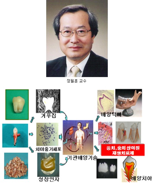 사랑니로 `바이오치아` 만든다