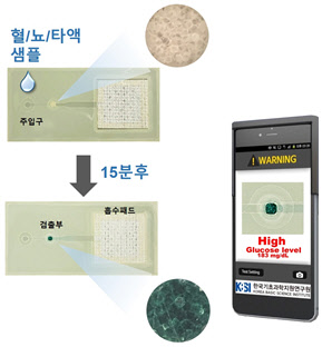 채혈 걱정 끝… 소변·타액으로 당뇨병 진단